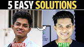 Get Back Your Original Skin Color | My Personal Journey & 5 Proven Solutions - In Hindi