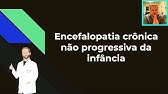 Encefalopatia crônica não progressiva da infância - Paralisia Cerebral - #aula completa