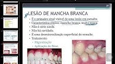 CARIOLOGIA PARTE 3