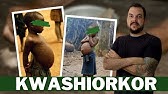 Kwashiorkor - Subnutrição por carência de aminoácidos
