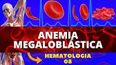 ANEMIA MEGALOBLÁSTICA - HEMATOLOGIA (ESTUDO DAS ANEMIAS)