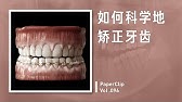 Vol.096 如何科学地矫正牙齿？