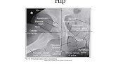 Hip and pelvis image evaluation
