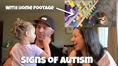 Autism Early Signs | Toddler Signs Of Autism With Footage