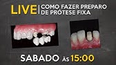 LIVE #060 - Como fazer preparo de prótese fixa