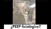 📎 ¿PEEP fisiológico? 🤔 🫁