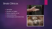 Endometrite em Éguas