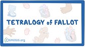 Tetralogy of Fallot (Year of the Zebra)