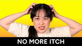 How to fix your itchy scalp: the science