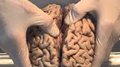 Introduction: Neuroanatomy Video Lab - Brain Dissections