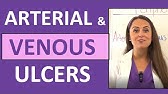 Arterial Ulcers vs. Venous Ulcers Nursing (Characteristics) for PVD (Peripheral Vascular Disease)