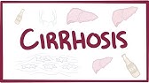 Cirrhosis - causes, symptoms, diagnosis, treatment, pathology