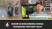 BANJIR DI BANJARBARU  WARGA TERSERANG PENYAKIT KULIT