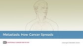 Metastasis: How Cancer Spreads