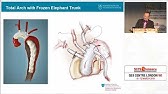 SCTS 19 T Sundt Replacement of the ascending aorta and resuspension of aortic valve, Against