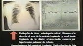 3.1. Semiología Médica de Lasala: El examen físico del aparato cardiovascular 2/3