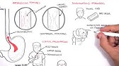 GORD (GERD) Gastro Oesophageal Reflux Disease  - Overview pathophysiology, treatment