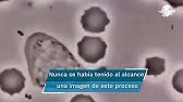 Así se ve un glóbulo blanco humano persiguiendo a una bacteria