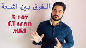 الفرق بين الاشعة x-ray , ct scan , MRI