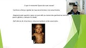 Desnutrição Infantil: Marasmo e Kwashiorkor