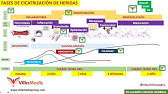 FASES DE LA CICATRIZACIÓN DE HERIDAS BY @mbaclinicsurgery