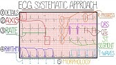 ECG Interpretation Made Easy (Learn How to Interpret an ECG in 13 Minutes)