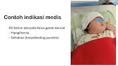 PARTTTUS - Pemberian susu formula