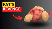 We FINALLY Found a Way To Starve Cancer